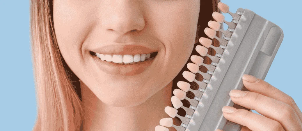 Choosing a Conservative Veneer Plan That Fits Your Smile