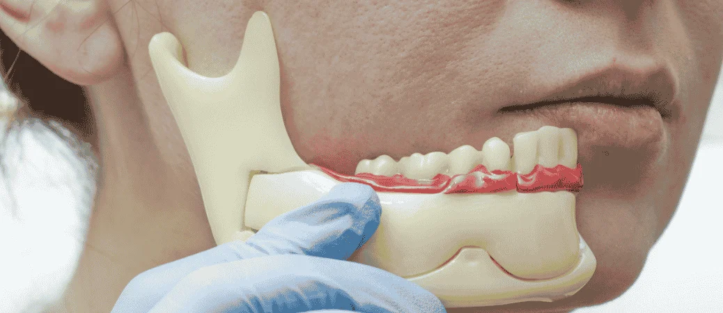 Choosing the Implant Timeline That Fits Your Needs
