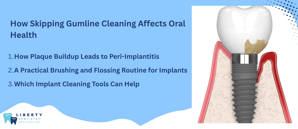 Skipping Daily Cleaning Around the Gumline
