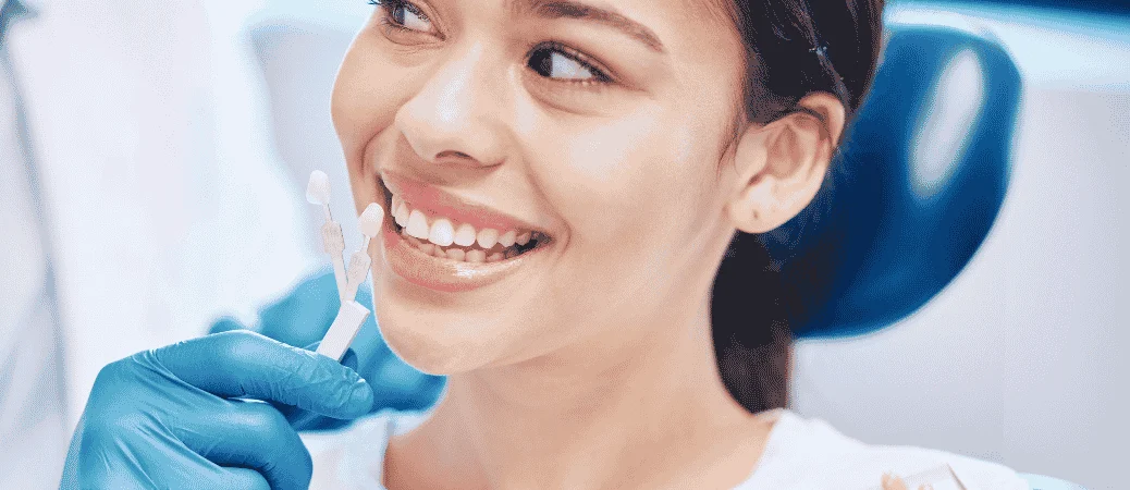 How Much Tooth Needs to Be Showing for Veneers to Work?