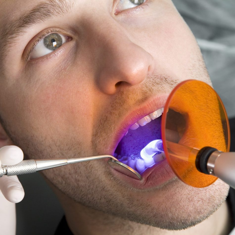 Male patient during a dental treatment. Close-up.