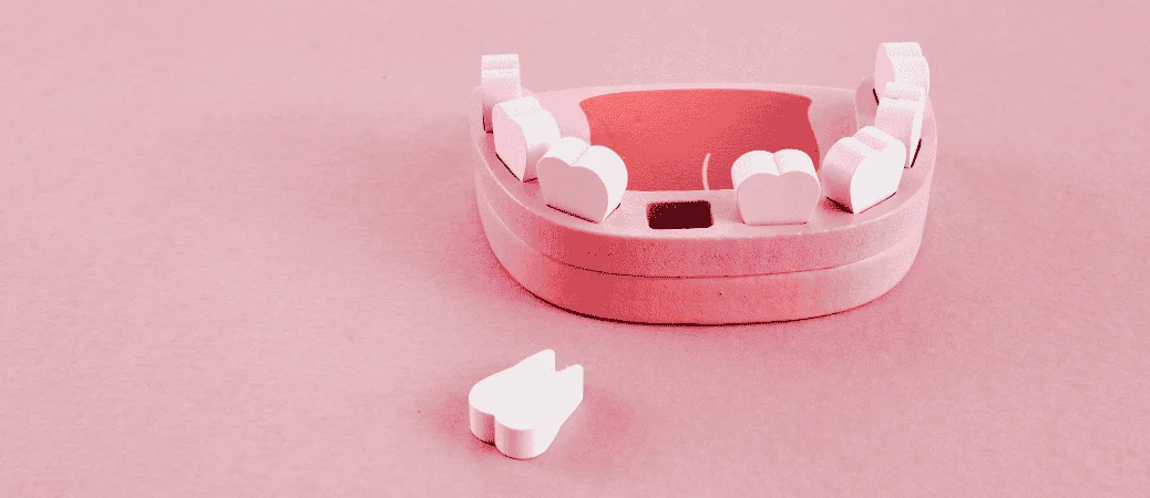 What Happens If You Wait Too Long to Replace a Missing Tooth? Consequences and Solutions